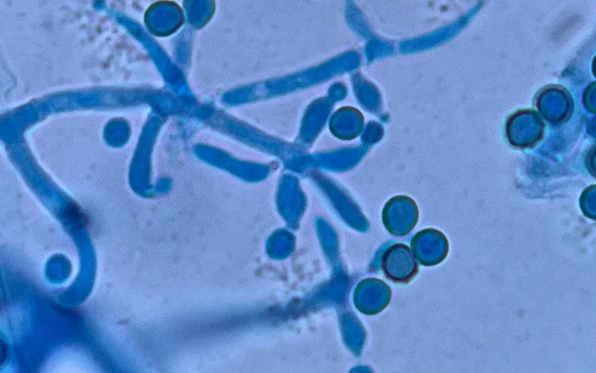 Rhizobacteria och Trichoderma